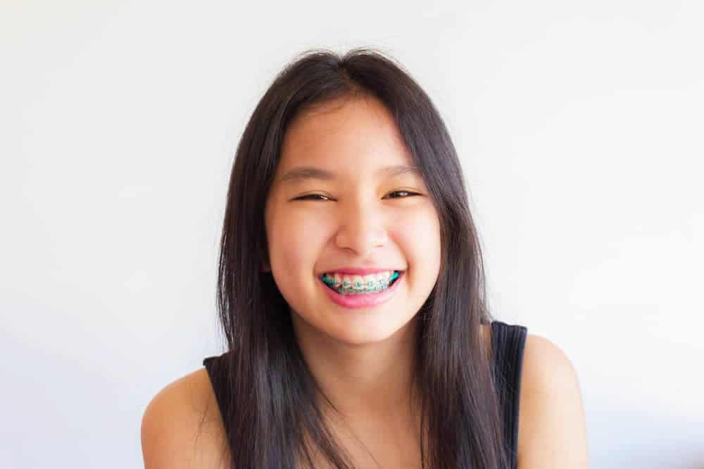 teenage-girl-braces