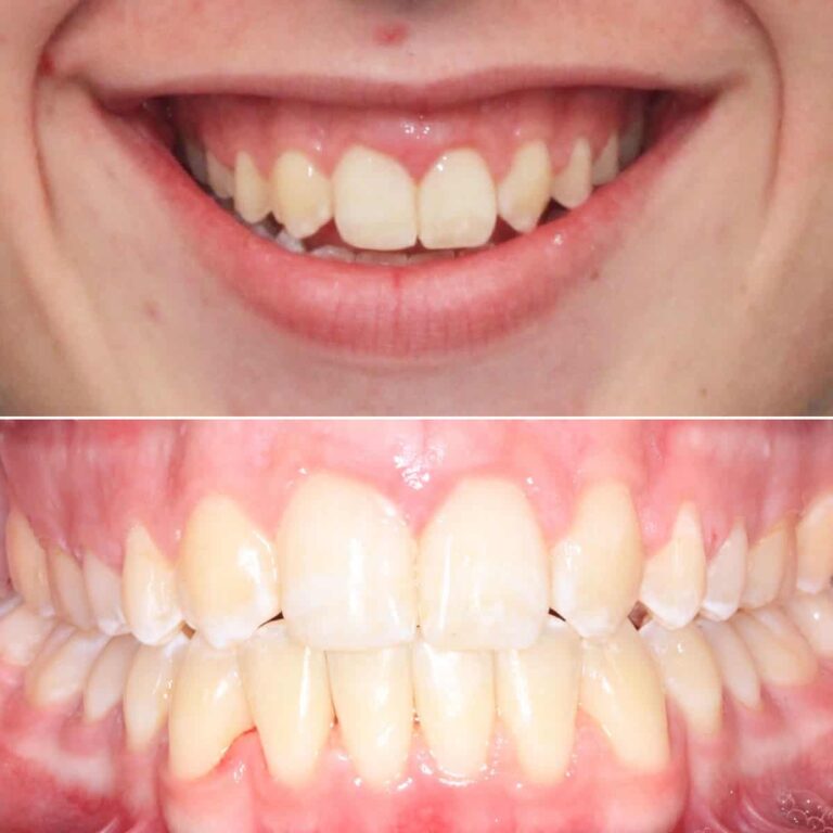 After treatment Case 1