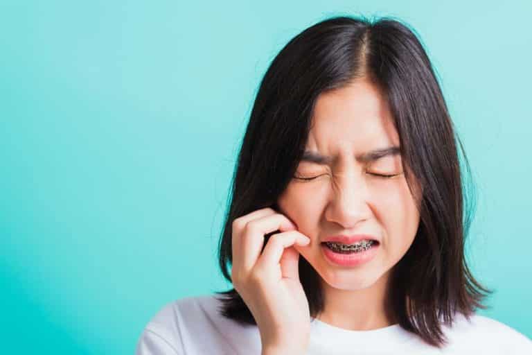Young woman with braces holding her cheek in discomfort, showing signs of orthodontic pain.